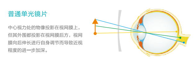 雙11（9）